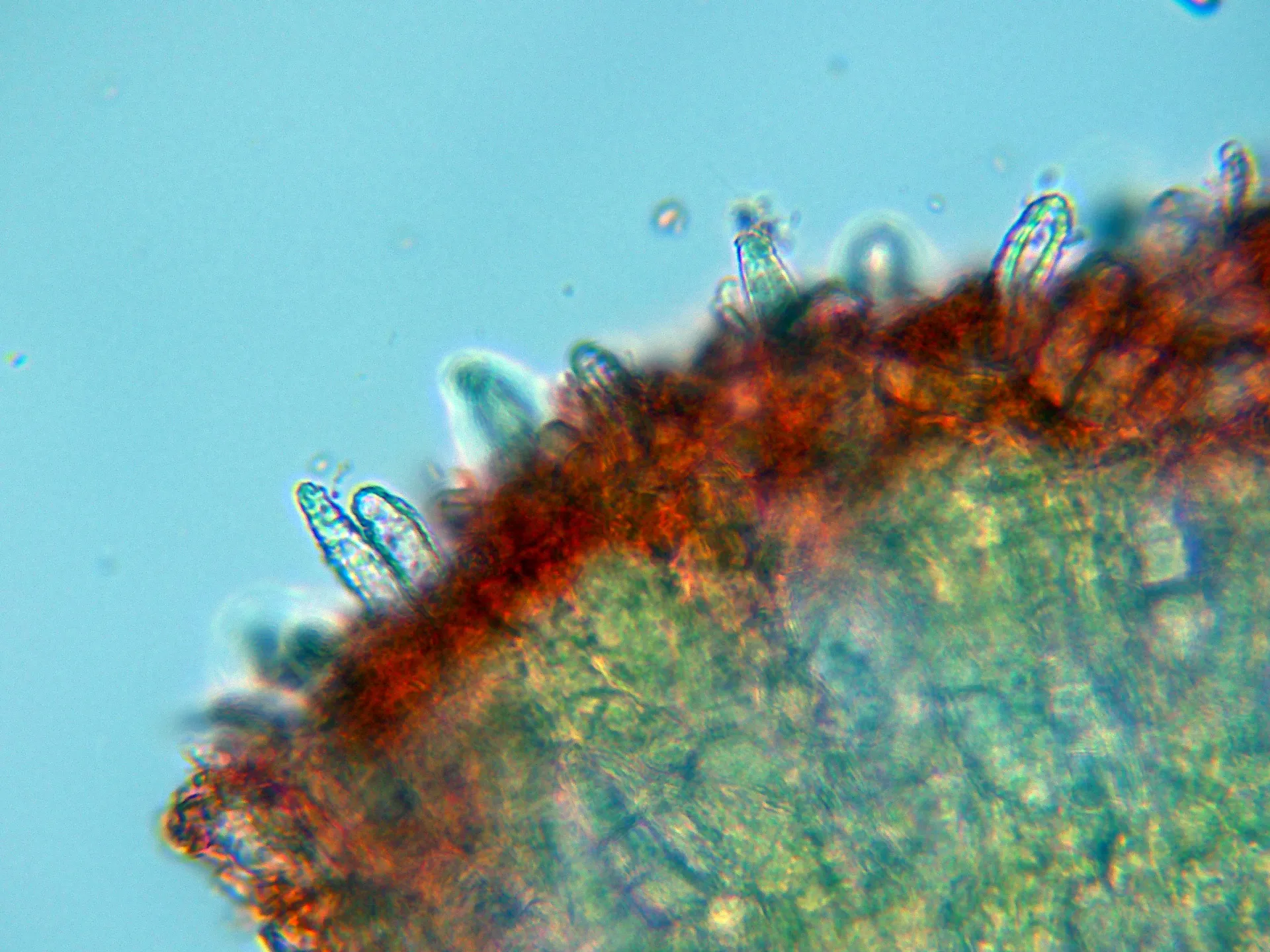 Microscopía de Peniophora boidinii - 10 - Himenio-001
